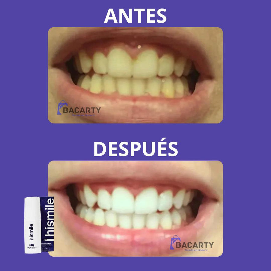 [50% OFF] Blaqueador Dental Hismile - Llévese el tercero gratis